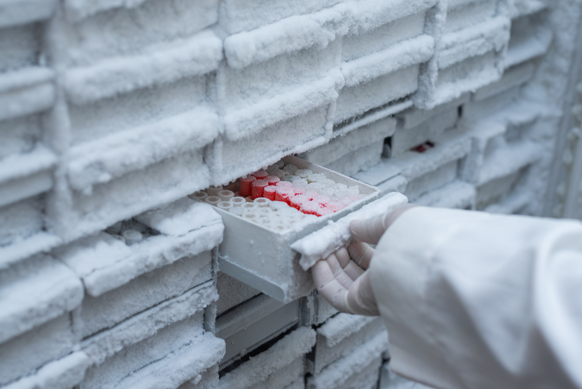 Hand pulling out samples from the cryopreservation storage freezer at the microbiology laboratory, in Nigeria